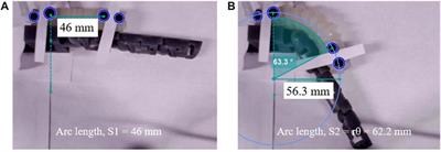 Modeling multi-contact point physical interaction between the anthropomorphic finger and soft robotic exo-digit for wearable rehabilitation robotics applications